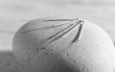 Иглы для иглоукалывания - Квинмед